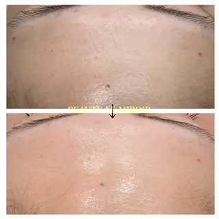 ビューティー ミロワールのエステ・リラクイメージ