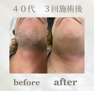 💠the4💠【脱毛特化サロン】所属・LED脱毛サロン 💐ayaのエステ・リラクイメージ