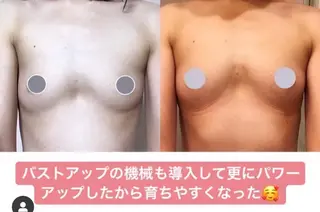 バストサロン emiruka所属・バストアップサロン エミルカのその他イメージ