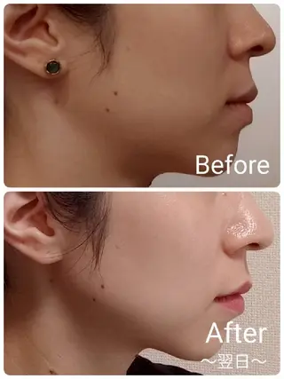 ICHOOSE/ 代々木上原のエステ・リラクイメージ