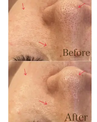 Freude所属・Freude Yamaguchiのマツエク・マツパデザイン