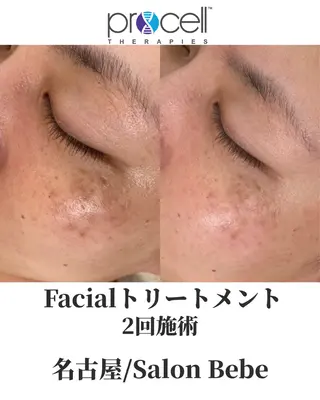 Salon Bebe 名古屋のエステ・リラクイメージ