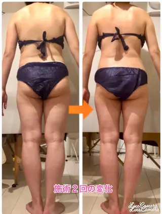 ショート カラー パーマ ヘアアレンジ メンズ キッズ ネイル マツエク・マツパ ‍痩身＆ボディ 結果出し🌟丹野のエステ・リラクイメージ