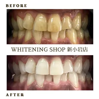 メンズ ホワイトニング ショップ新小岩店のその他イメージ