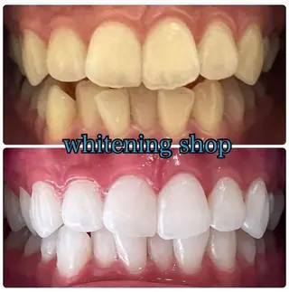 ホワイトニング ショップ吉祥寺店のエステ・リラクイメージ