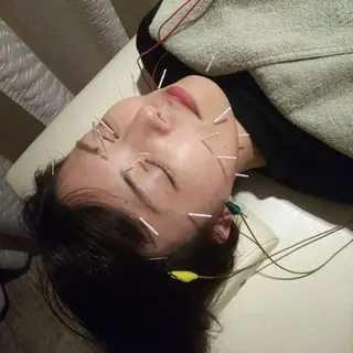 むくみたるみ専門☆ 美容鍼・小顔矯正のエステ・リラクイメージ