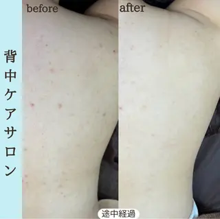 ベラージュ【美背中・ 美尻・フェイシャル】のエステ・リラクイメージ