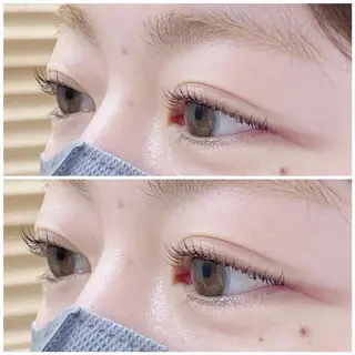 マツエク・マツパ taachi  due所属・taachi due SUZUNAのエステ・リラクイメージ