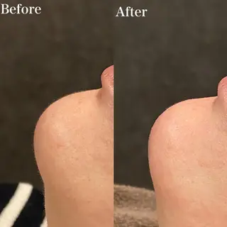 SHAPYパラジェル フィルイン対応　うみのマツエク・マツパデザイン