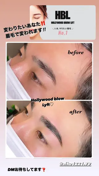 アイブロウ ハーブピーリング/韓国肌管理/フェイシャル/毛穴洗浄/眉毛/顔脱毛【糸脱毛専門】rev所属・ハーブピーリング🌹 毛穴洗浄❤️眉waxのエステ・リラクイメージ