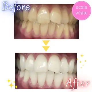 エクシア仙台駅東口店所属・セルフホワイトニング エクシア仙台駅東口店のその他イメージ