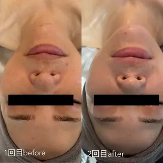 エステティックサロン Liente(リアンテ)所属・Hashimoto .のエステ・リラクイメージ