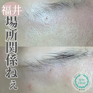 毛穴肌質ケアサロン Yourmeユアミーのエステ・リラクイメージ