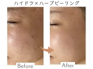 プライベートサロン Belle（ベル）のエステ・リラクイメージ