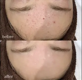 DahliaBeauty ダリアビューティー所属・Dahlia痩身脱毛 フェイシャル 中村のエステ・リラクイメージ