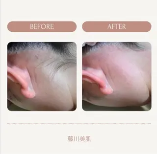 藤川美肌製造所所属・藤川 明花のエステ・リラクイメージ