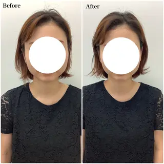 メディカルサロンドオフ所属・ハリサロンドオフ 美容鍼灸×小顔整体のエステ・リラクイメージ