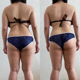 むくみ専門痩身 マクイエステティックのエステ・リラクイメージ