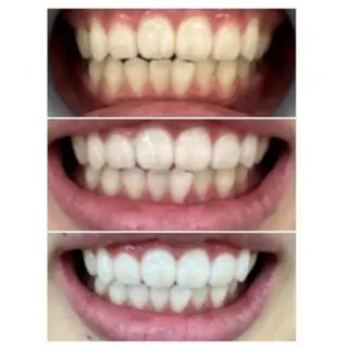 M渋谷店所属・Ｍ渋谷 ホワイトニングのエステ・リラクイメージ