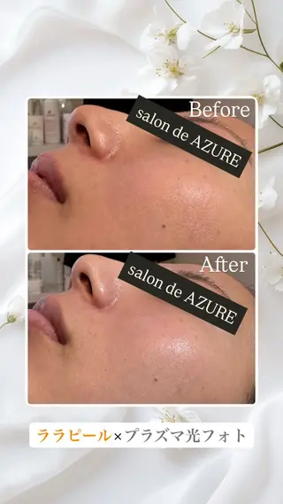 春日井/脱毛・エステサロン salon de AZURE所属・salon de AZUREのエステ・リラクイメージ