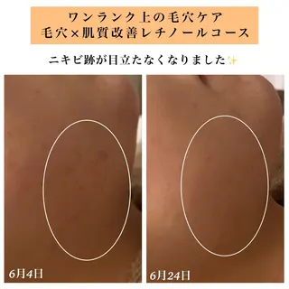 Bellesthe （ベルエステ）のエステ・リラクイメージ