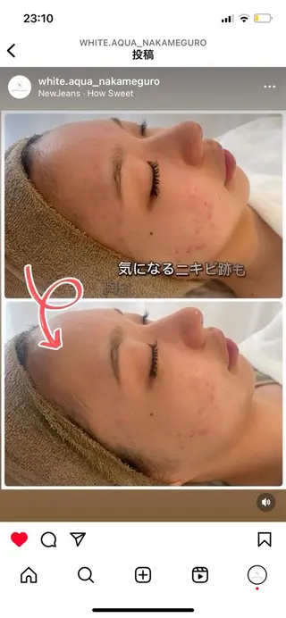 中目黒ハーブピーリン グ🌿ララピールのエステ・リラクイメージ