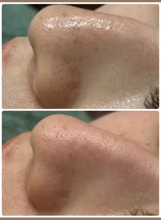 美肌脱毛サロン muroのエステ・リラクイメージ