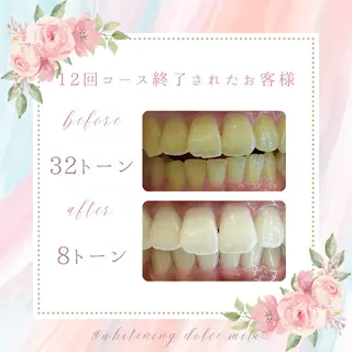 セルフホワイトニング Dolce八王子店のその他イメージ