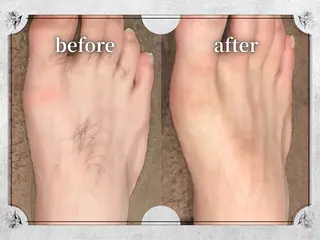 都度払い脱毛 Lino柏/Moneのエステ・リラクイメージ