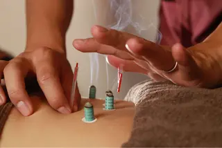 こもれび 鍼灸整骨院のその他イメージ