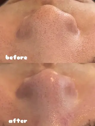 リンパ×ハーブ蒸し TIARA.烏丸三条のエステ・リラクイメージ