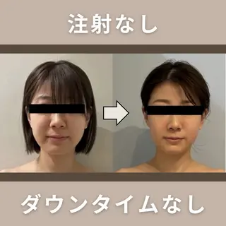 美容室BAUM所属・脂肪コントロール まさえのその他イメージ