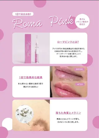 医療提携Ruby所属・医療提携Ruby小顔 ハーブピーリングのその他イメージ