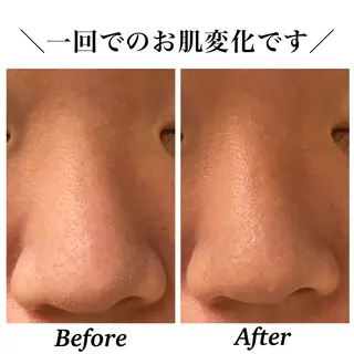 Bellesthe （ベルエステ）のエステ・リラクイメージ