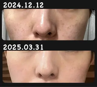 ulu. (ユール)のエステ・リラクイメージ