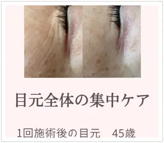 オーガニック エステ サロンフィオーレの眉毛・アイブロウイメージ