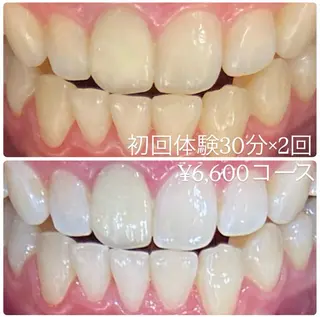 PLATINUM Beauty 横浜店所属・ホワイトニングルーム 横浜店のその他イメージ