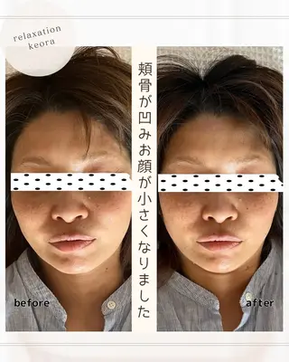 小顔矯正& 慢性肩こり腰痛改善店のエステ・リラクイメージ