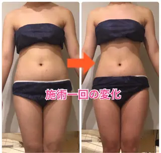 ロング カラー パーマ ヘアアレンジ メンズ キッズ ネイル マツエク・マツパ ‍痩身＆ボディ 結果出し🌟丹野のエステ・リラクイメージ