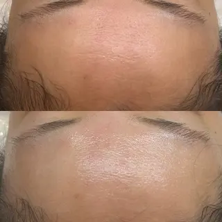 韓国🇰🇷価格 サロン_Nbibiのエステ・リラクイメージ