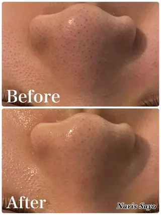 デ・アイム豊中所属・朝山 紗世子のエステ・リラクイメージ