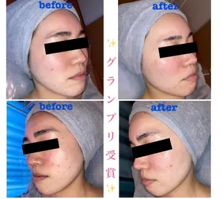 フェイシャルエステLe・Ciel所属・Le・Ciel フェイシャル&ボディのエステ・リラクイメージ