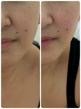 フェイシャルエステ アンソン・ドゥのエステ・リラクイメージ