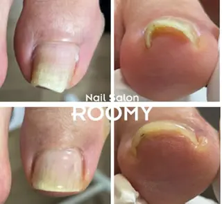 ネイル イワサキ  のネイルデザイン