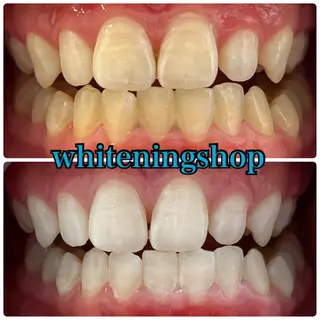 ホワイトニング ショップ吉祥寺店のエステ・リラクイメージ