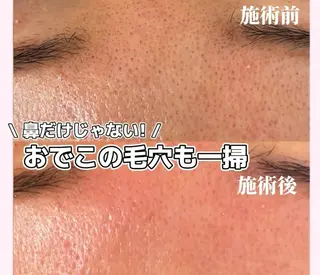 Reliora 【京都最安値】のエステ・リラクイメージ