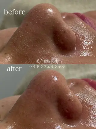 フェイシャルサロン CHIARA鈴木のエステ・リラクイメージ