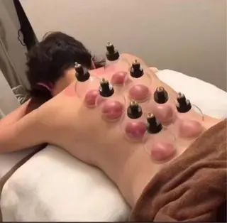 リラクゼーションサロン四つ葉のクローバー所属・[カッピング・美肌] セラピストようこのエステ・リラクイメージ