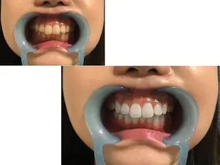 アイブロウ マツエク・マツパ ネイル キッズ カラー パーマ ヘアアレンジ メンズ 中目黒 ホワイトニングサロンのその他イメージ