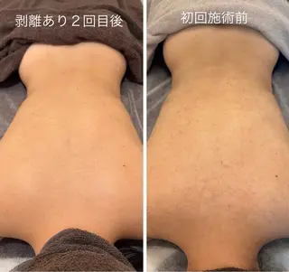 腸活・むくみとり・ ハーブピーリングのエステ・リラクイメージ